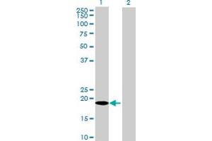 Image no. 2 for anti-Ubiquitously-Expressed, Prefoldin-Like Chaperone (UXT) (AA 1-169) antibody (ABIN521879)