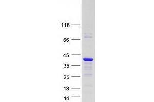 Image no. 1 for Vestigial Like 4 (VGLL4) (Transcript Variant 2) protein (Myc-DYKDDDDK Tag) (ABIN2735252)