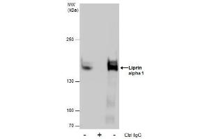 Image no. 1 for anti-Protein Tyrosine Phosphatase F Interacting Protein 1 (PPFIA1) (N-Term) antibody (ABIN2856986)
