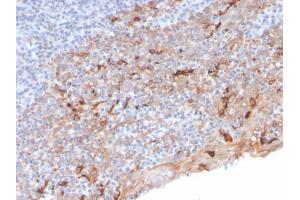 Image no. 5 for anti-Hepatitis A Virus Cellular Receptor 2 (TIM 3) (AA 22-202) antibody (ABIN6940963)