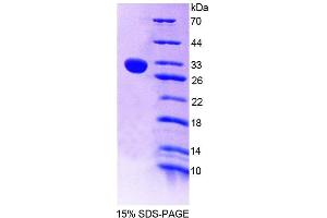 Image no. 1 for Chitotriosidase (CHIT1) (AA 210-464) protein (His tag) (ABIN6237252)