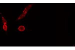 Image no. 2 for anti-MRE11 Meiotic Recombination 11 Homolog A (S. Cerevisiae) (MRE11A) (C-Term) antibody (ABIN6259110)