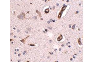 Image no. 3 for anti-UDP-N-Acetyl-alpha-D-Galactosamine:polypeptide N-Acetylgalactosaminyltransferase 10 (GalNAc-T10) (GALNT10) (C-Term) antibody (ABIN6657270)