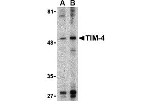 Image no. 1 for anti-T-Cell Immunoglobulin and Mucin Domain Containing 4 (TIMD4) (Middle Region) antibody (ABIN1031125)