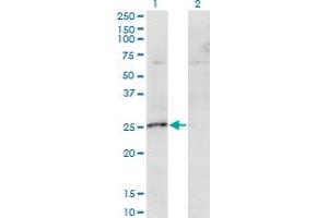 anti-MIS12, MIND Kinetochore Complex Component, Homolog (MIS12) (AA 1-205) antibody
