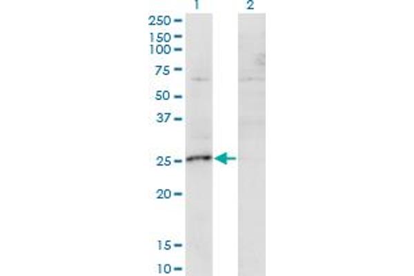 anti-MIS12, MIND Kinetochore Complex Component, Homolog (MIS12) (AA 1-205) antibody
