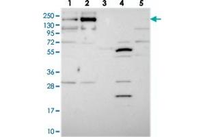 Image no. 1 for anti-Transmembrane Protein 2 (TMEM2) antibody (ABIN5589672)