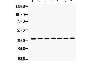 Image no. 2 for anti-Histone Deacetylase 11 (HDAC11) (AA 47-81), (N-Term) antibody (ABIN3043840)