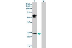 Image no. 1 for anti-TGFB-Induced Factor Homeobox 2 (TGIF2) (AA 1-237) antibody (ABIN528411)