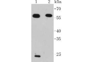 Image no. 1 for anti-Interferon Regulatory Factor 7 (IRF7) antibody (ABIN5557323)