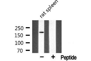 Image no. 2 for anti-MutL Homolog 3 (MLH3) antibody (ABIN6259107)