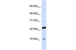 Image no. 1 for anti-TAF13 RNA Polymerase II, TATA Box Binding Protein (TBP)-Associated Factor, 18kDa (TAF13) (N-Term) antibody (ABIN6743455)