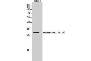 Image no. 1 for anti-Ephrin B1 (EFNB1) (pTyr317) antibody (ABIN3182253)