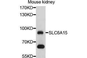 Image no. 1 for anti-Solute Carrier Family 6 (Neutral Amino Acid Transporter), Member 15 (SLC6A15) antibody (ABIN4905212)