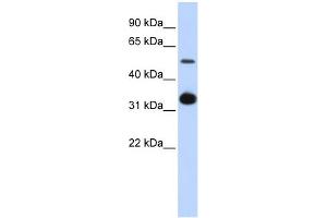 Image no. 1 for anti-Growth Differentiation Factor 2 (GDF2) (Middle Region) antibody (ABIN2786157)