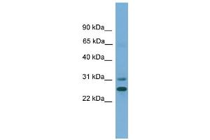 Image no. 2 for anti-Dehydrogenase/reductase (SDR Family) Member 2 (DHRS2) (N-Term) antibody (ABIN2775324)