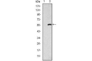 Image no. 1 for anti-SMAD, Mothers Against DPP Homolog 2 (SMAD2) antibody (ABIN1109058)