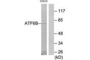 Image no. 1 for anti-Activating Transcription Factor 6 beta (ATF6B) (AA 401-450) antibody (ABIN1534086)