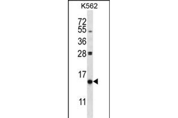 PIK3IP1 antibody  (C-Term)