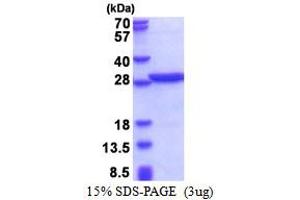 Image no. 1 for Poly A Binding Protein Nuclear 1 (PABPN1) (AA 119-306) protein (His tag) (ABIN5853467)