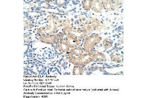 Image no. 4 for anti-Dihydrolipoyl Transacetylase (DLAT) (N-Term) antibody (ABIN2777101)