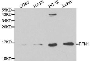 Image no. 1 for anti-Profilin 1 (PFN1) antibody (ABIN3021599)