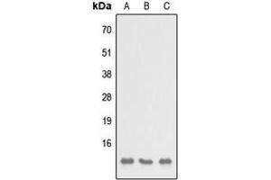 Image no. 1 for anti-SH3 Domain Binding Glutamic Acid-Rich Protein Like 3 (SH3BGRL3) (Center) antibody (ABIN2707043)