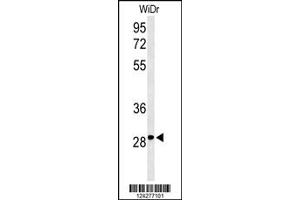 Image no. 1 for anti-Nicotinamide Riboside Kinase 1 (NMRK1) antibody (ABIN2158009)