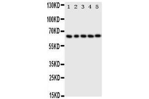 Image no. 2 for anti-Tumor Protein P63 (TP63) (AA 664-680), (C-Term) antibody (ABIN3044067)