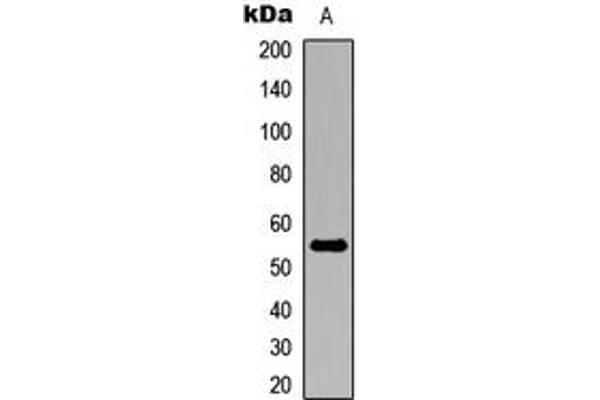 anti-Aldehyde Dehydrogenase 1 Family, Member A2 (ALDH1A2) (C-Term) antibody