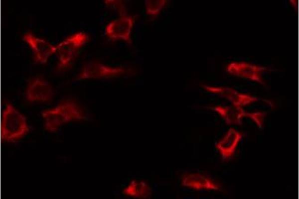 anti-Mitochondrial Ribosomal Protein S17 (MRPS17) (Internal Region) antibody
