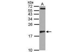 Image no. 3 for anti-Actin Related Protein 2/3 Complex, Subunit 5-Like (ARPC5L) (AA 1-153) antibody (ABIN1501988)