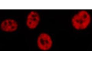 Image no. 3 for anti-Jun Proto-Oncogene (JUN) (pSer73) antibody (ABIN6255488)