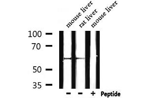 Image no. 5 for anti-Catalase (CAT) antibody (ABIN6260491)