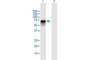 Image no. 1 for anti-Zinc Finger (CCCH Type), RNA-Binding Motif and serine/arginine Rich 2 (ZRSR2) (AA 1-482) antibody (ABIN1774824)