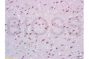 Formalin-fixed and paraffin embedded rat brain tissue labeled with Anti-Cathepsin B Polyclonal Antibody, Unconjugated (ABIN687412) at 1:200 followed by conjugation to the secondary antibody, (SP-0023), and DAB staining