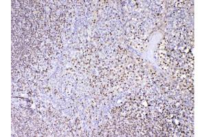 Image no. 2 for anti-Paired Box 5 (PAX5) (AA 217-282) antibody (ABIN5692907)