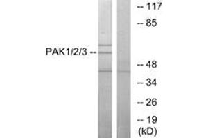 Image no. 1 for anti-P21-Activated Kinases 1/2/3 (PAK1/2/3) (AA 391-440) antibody (ABIN1532384)