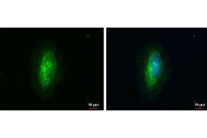 ICC/IF Image ARHGAP1 antibody [N1N3] detects ARHGAP1 protein at cytoplasm by immunofluorescent analysis.