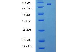DEAD (Asp-Glu-Ala-As) Box Polypeptide 19A (DDX19A) (AA 1-478), (full length) protein (His-SUMO Tag)