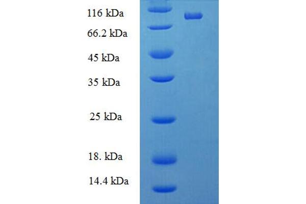 DEAD (Asp-Glu-Ala-As) Box Polypeptide 19A (DDX19A) (AA 1-478), (full length) protein (His-SUMO Tag)