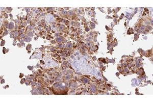 Image no. 5 for anti-Collagen, Type I, alpha 2 (COL1A2) (N-Term) antibody (ABIN6258438)
