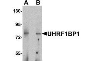 Image no. 1 for anti-UHRF1 Binding Protein 1 (UHRF1BP1) (Middle Region) antibody (ABIN1450049)