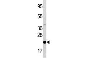 Image no. 3 for anti-BCL2-Associated Agonist of Cell Death (BAD) (AA 53-81) antibody (ABIN3030115)