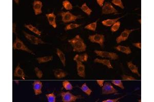 Immunofluorescence analysis of L929 cells using CYR61 Polyclonal Antibody at dilution of 1:100.