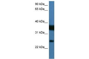 Image no. 2 for anti-Zinc Finger, Matrin Type 2 (ZMAT2) (N-Term) antibody (ABIN2776637)