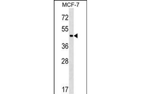 ZBTB12 抗体  (C-Term)