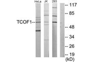 Image no. 1 for anti-Treacher Collins-Franceschetti Syndrome 1 (TCOF1) (AA 41-90) antibody (ABIN1533867)