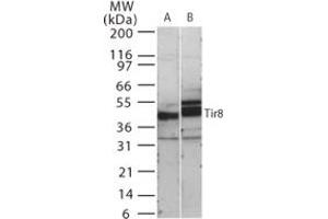 Image no. 1 for anti-Single Immunoglobulin and Toll-Interleukin 1 Receptor (TIR) Domain (SIGIRR) (AA 334-358) antibody (ABIN208840)