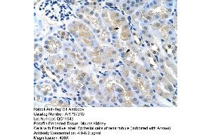 Image no. 3 for anti-Tumor Susceptibility Gene 101 (TSG101) (Middle Region) antibody (ABIN2780037)